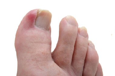 https://www.farnboroughfoothealth.co.uk/images/nail_treatments.jpg